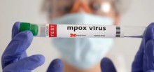 Estados Unidos confirmam primeiro caso de nova variante da mpox