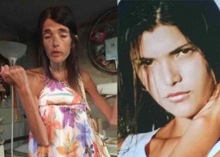 Atualmente, Simone Brasil luta contra a anorexia (CRÉDITO: REPRODUÇÃO/INTERNET)