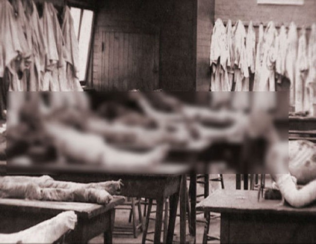 Entre um assassinato sinistro e outro, ele dissecava os cadáveres e vendia partes para escolas de medicina (CRÉDITO: REPRODUÇÃO)