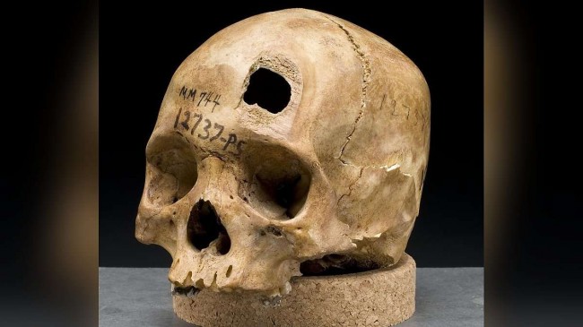 Fóssil de 75 mil anos pode ser um dos homicídios mais antigos já registrados